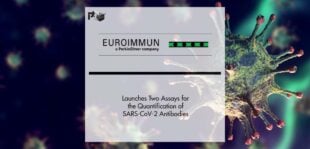 EUROIMMUN Launches Two Assays for the Quantification of SARS-CoV-2 Antibodies | Pharmtech Focus