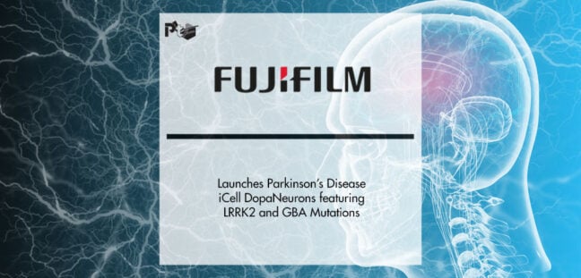 FUJIFILM Cellular Dynamics Launches Parkinson’s Disease iCell DopaNeurons featuring LRRK2 and GBA Mutations | Pharmtech Focus
