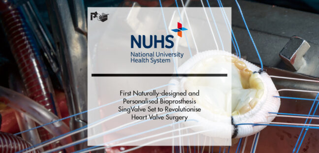 First Naturally-designed and Personalised Bioprosthesis SingValve Set to Revolutionise Heart Valve Surgery | Pharmtech Focus