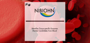 NIBIOHN Identifies Tissue-specific Exosome Marker Candidates from Blood | Pharmtech Focus