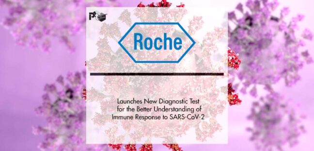 Roche Launches New Diagnostic Test for the Better Understanding of Immune Response to SARS-CoV-2 | Pharmtech Focus