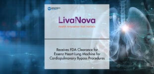 LivaNova Receives FDA Clearance for Essenz Heart-Lung Machine for Cardiopulmonary Bypass Procedures | MTA